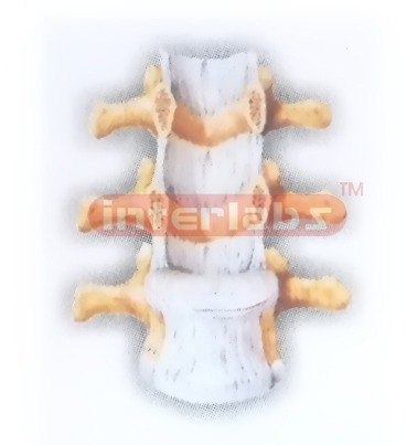 HUMAN INTERVERTEBRAL JOINTS (ANTERIOR ASPECT) MODEL